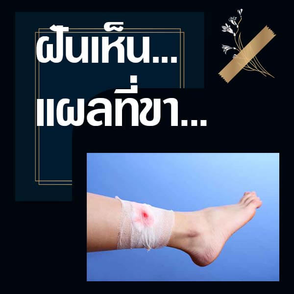 แทงหวย 24 ทำนายฝันเห็นแผลที่ขา