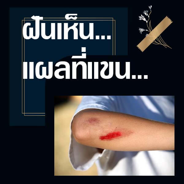 เว็บหวย ทำนายฝันเห็นแผลที่แขน